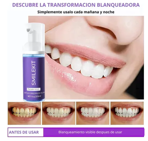 ✨😁SONRIE SIN VERGUENZA CON LA ESPUMA BLANQUEADORA INSTANTANEA  😁✨ ENVIO GRATIS + PAGO CONTRA ENTREGA✈️