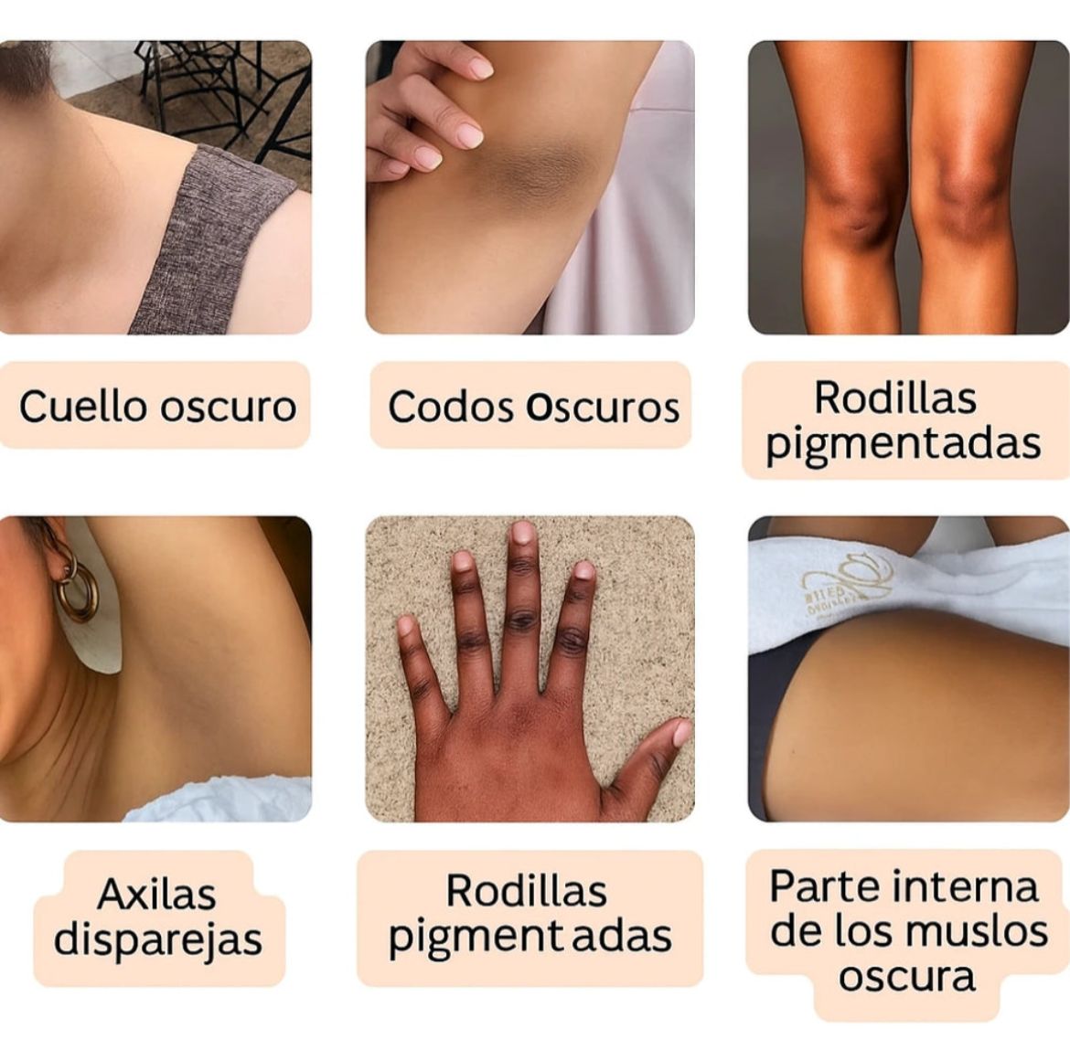 Dr.  Melaxin Tratamiento: Despigmentante a base de cúrcuma en spray