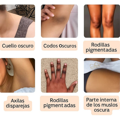 Dr.  Melaxin Tratamiento: Despigmentante a base de cúrcuma en spray